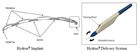 Hydrus Implant & Delivery System